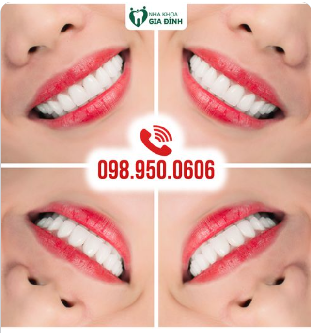 GIÚP BẠN TỰ TIN NỞ NỤ CƯỜI RẠNG RỠ SUỐT MỘT ĐỜI