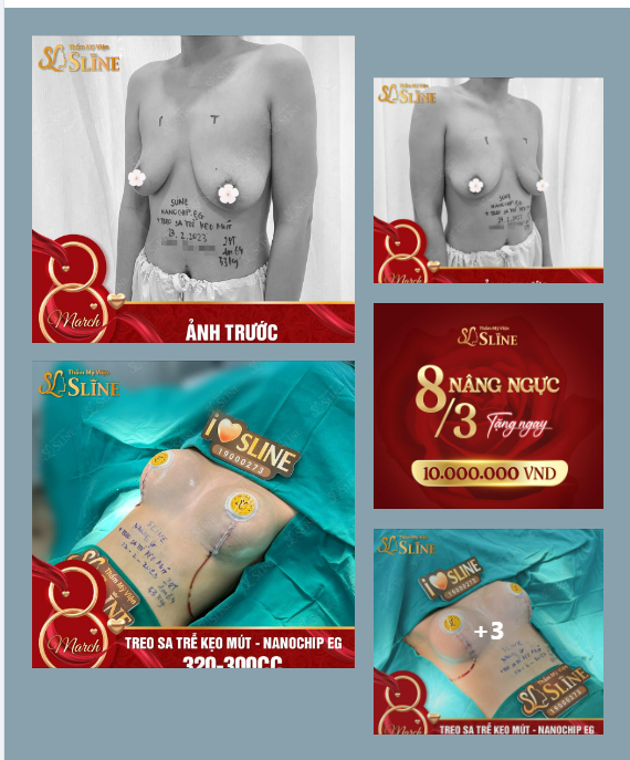 CHÀO NGÀY MỚI - NĂNG LƯỢNG MỚI Cùng Sline thự hiện combo TREO SA TRỄ KẸO MÚT + NANOCHIP EG :