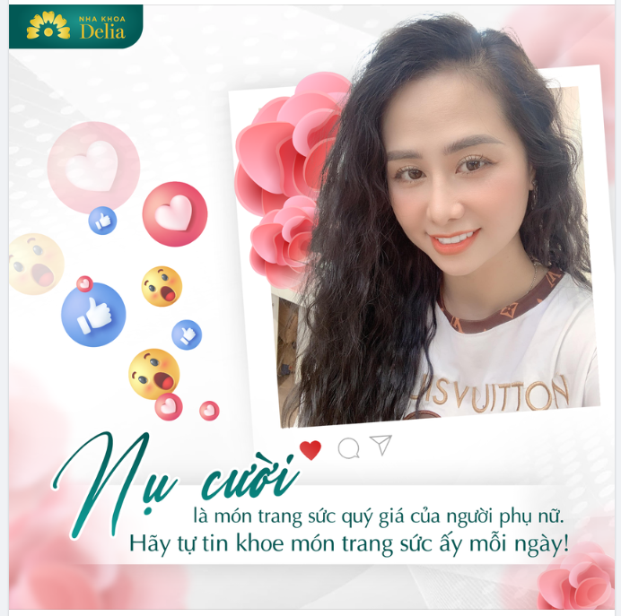 MÓN TRANG SỨC ĐẸP NHẤT CỦA PHÁI ĐẸP CHÍNH LÀ NỤ CƯỜI