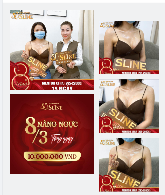 NGỰC XINH - THÊM PHẦN LUNG LINH - NHÌN LẠI V1 SAU 15 NGÀY NÂNG CẤP!