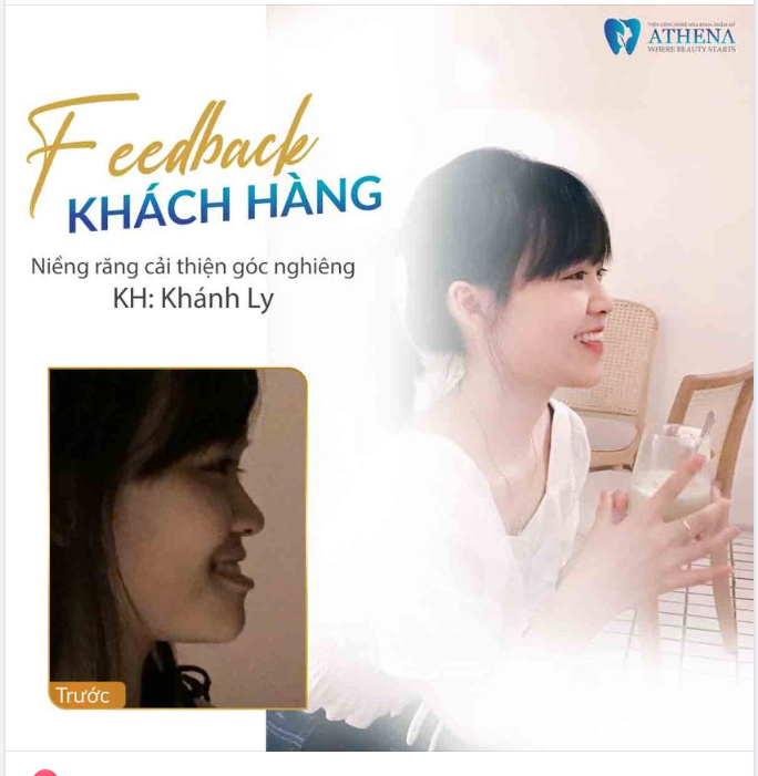 NIỀNG RĂNG - GIẢI QUYẾT VẤN ĐỀ HÔ