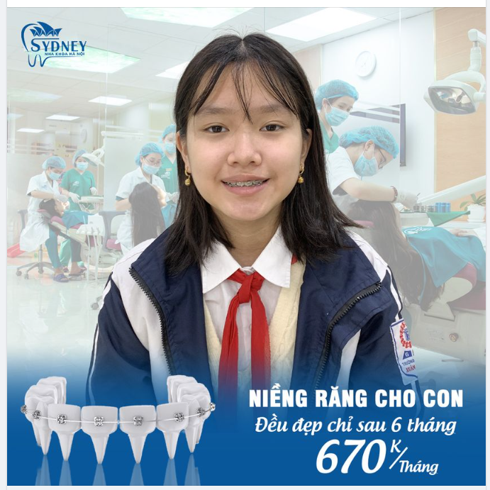 Niềng răng từ sớm, con tự tin vững bước vào đời