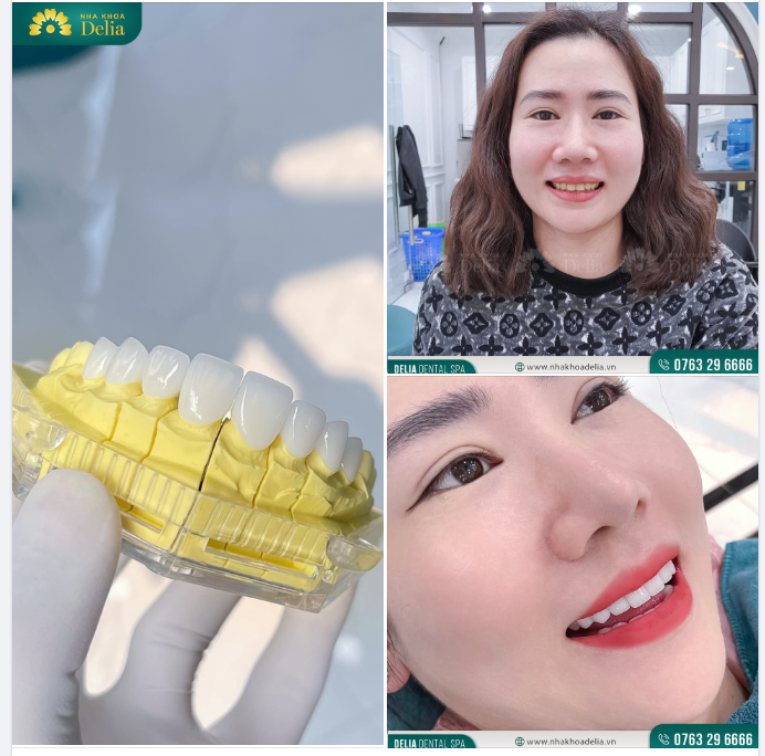Sự hài lòng của khách hàng là thước đo chân thực nhất cho sự tận tâm, tận tình và chất lượng của Nha khoa Delia