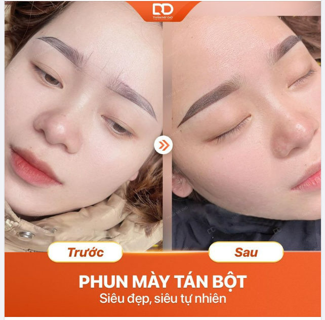 PHUN MÀY CHẠM HẠT VI ĐIỂM NANO - ĐẸP TỰ NHIÊN, HÀI HÒA GƯƠNG MẶT.