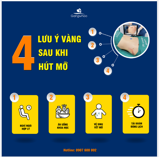 4 LƯU Ý VÀNG SAU KHI HÚT MỠ BẠN CẦN BIẾT