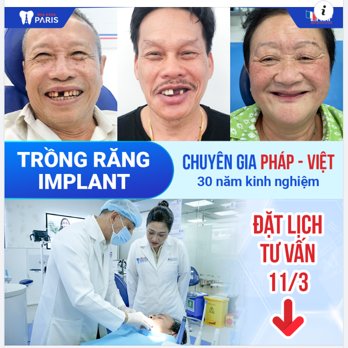 CHUYÊN GIA PHÁP VIỆT TRỰC TIẾP TƯ VẤN IMPLANT TẠI BỆNH VIỆN RHM THẨM MỸ PARIS LÀ AI?