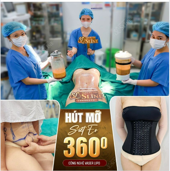 FEEDBACK KHÁCH HÀNG HÚT MỠ SIẾT EO 360° ĐÂY LÀ SỰ THAY ĐỔI “ NGỠ NGÀNG” CHO KHÁCH HÀNG.