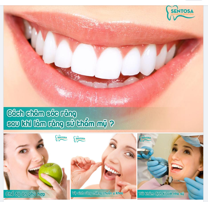 CHĂM SÓC RĂNG MIỆNG SAU LÀM RĂNG SỨ THẨM MỸ NHƯ THẾ NÀO