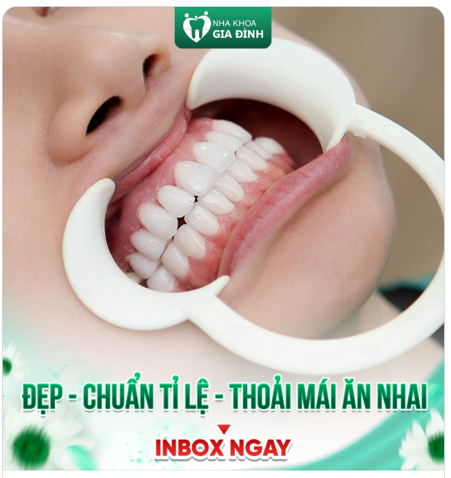 LỢI HỒNG SĂN CHẮC - FORM RĂNG CHUẨN TỈ LỆ - THOẢI MÁI ĂN NHAI