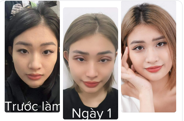 Đánh cược bản thân đầu năm đi cắt mí và mở góc mắt để cả năm nở hoa.