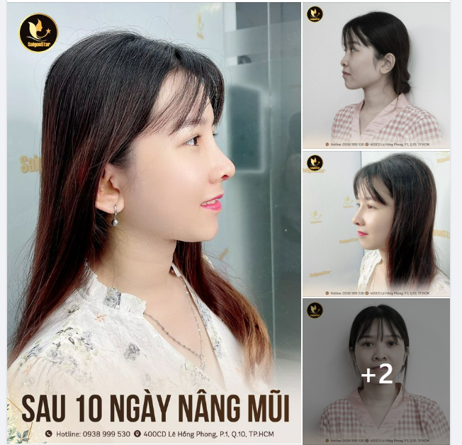 “Em tìm hiểu và thích dáng mũi bác Hoạt làm lâu rồi. Đến giờ mới dũng cảm đến đây làm. Kết quả sau 10 ngày khiến em rất hài lòng…” – Bạch Lê chia sẻ.