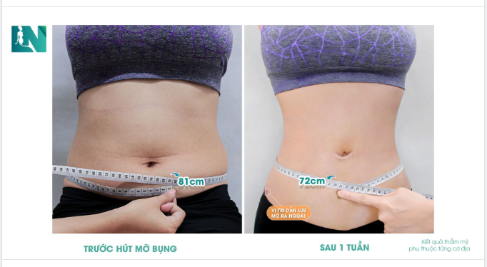 ĐƯỜNG EO SẮC NÉT – THẦN SẮC RẠNG NGỜI
