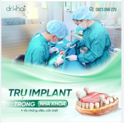 Cấy ghép Implant nha khoa là phương pháp phục hồi răng mất bằng cách đặt trụ kim loại (cấu tạo từ titanium) vào xương hàm nhằm thay thế cho chân răng thật đã mất.