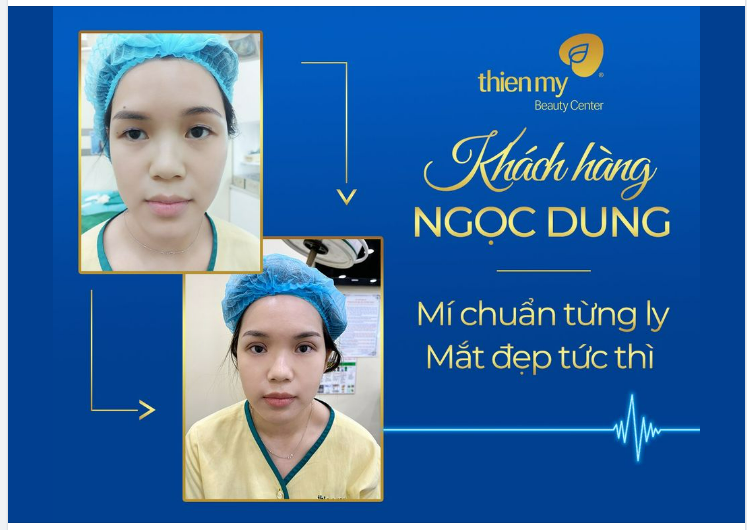 MÍ CHUẨN TỪNG LI - MẮT ĐẸP TỨC THÌ