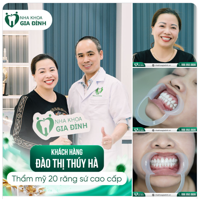 TRẺ HƠN 10 TUỔI VỚI NỤ CƯỜI MỚI
