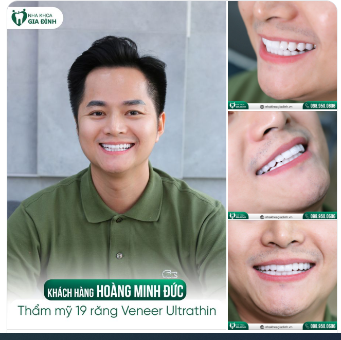 ĐẸP HƠN, LỊCH LÃM HƠN VỚI NỤ CƯỜI THẦN THÁI