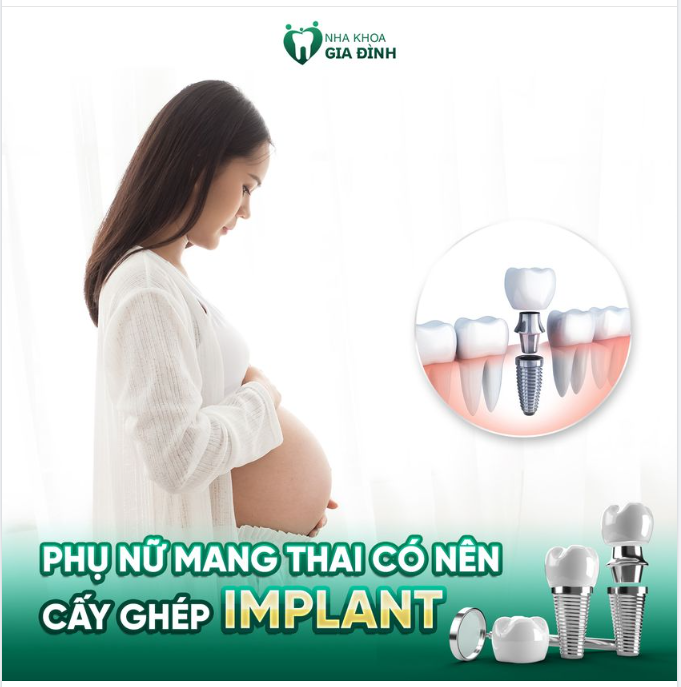ĐANG MANG THAI CÓ CẤY GHÉP IMPLANT ĐƯỢC KHÔNG?