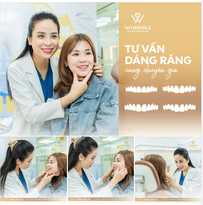 Tư vấn dáng răng cùng chuyên gia