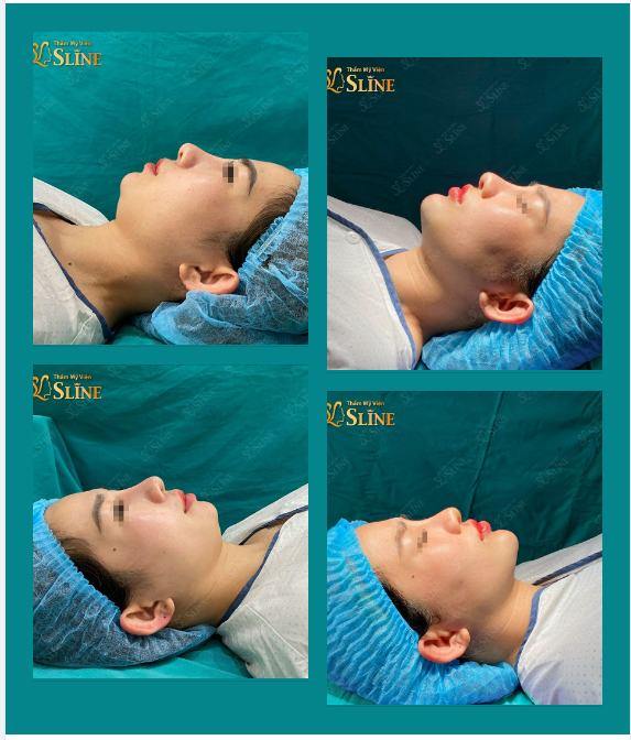ĐỘN CẰM SANG XỊN - CHUẨN TỈ LỆ VÀNG!