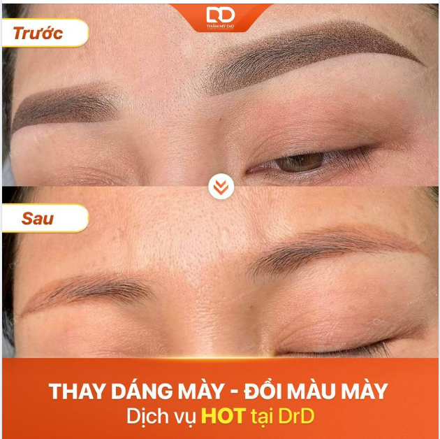 THAY DÁNG MÀY - ĐỔI MÀU MÀY - DỊCH VỤ HOT TẠI THẨM MỸ DRD.