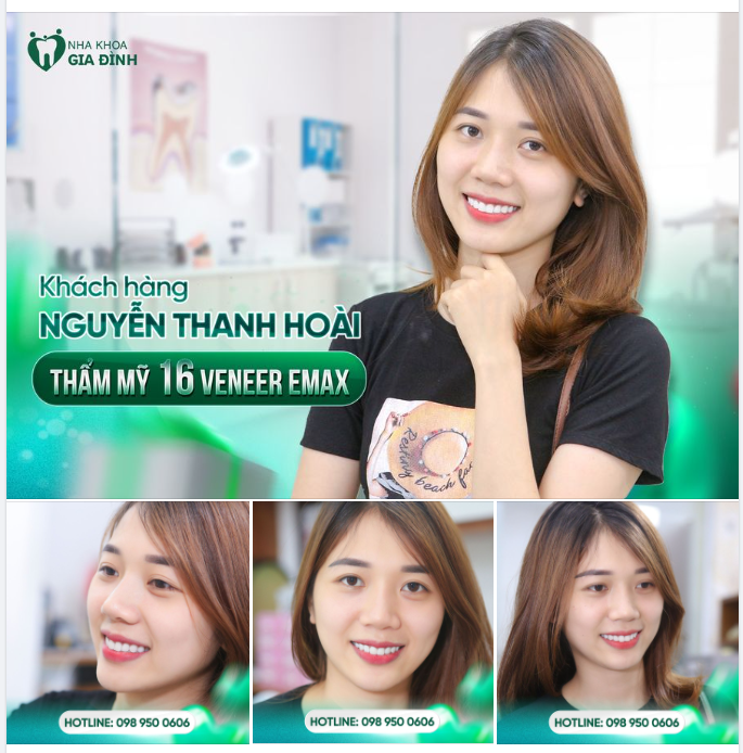 ẤN TƯỢNG VỚI NỤ CƯỜI THANH THOÁT, DỊU DÀNG CỦA NỮ KHÁCH HÀNG THANH HOÀI