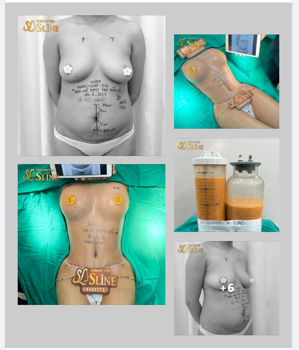 THAY VÓC DÁNG - ĐỔI CUỘC ĐỜI