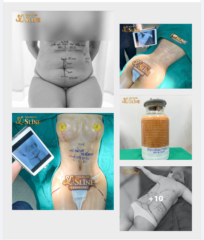 BODY HOÀN HẢO CHỈ CÓ THỂ LÀ COMBO ĐẶC BIỆT: