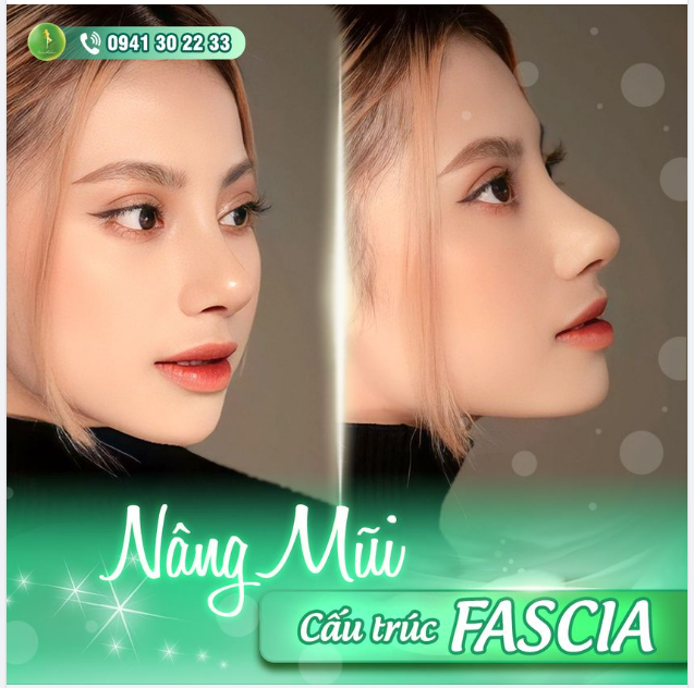 MŨI CẤU TRÚC FASCIA - THẢ GA NHẬN ƯU ĐÃI