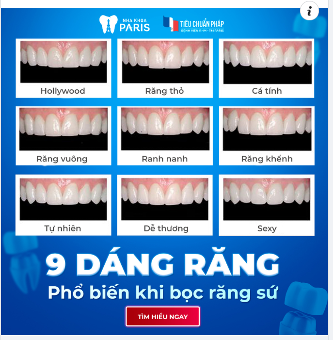 9 DÁNG RĂNG PHỔ BIẾN KHI BỌC RĂNG SỨ
