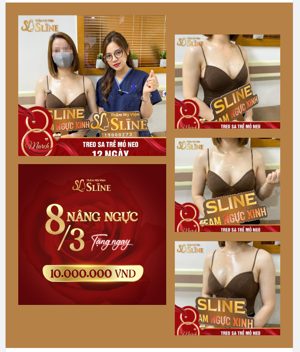 Sáng chủ nhật, dậy sớm để khoe sự xinh đẹp của case ngực ​​​​​​​ Sau 12 ngày.