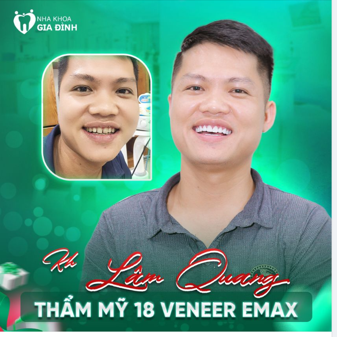 THAY ĐỔI NỤ CƯỜI GIÚP NGƯỜI ĐÀN ÔNG TRỞ NÊN LỊCH LÃM VÀ THẦN THÁI