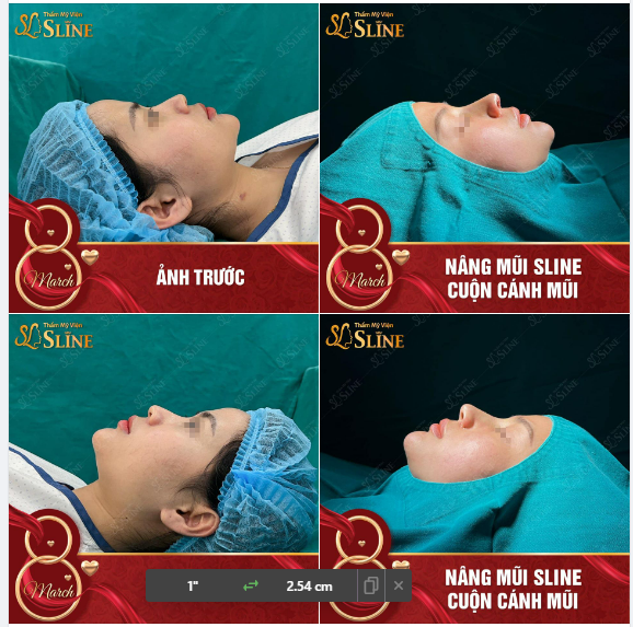 “SIÊU PHẨM” MŨI VỪA THỰC HIỆN, NHẸ NHÀNG THANH THOÁT