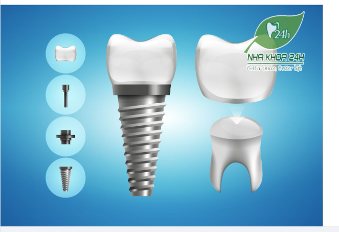 TẠI SAO CHI PHÍ TRỒNG RĂNG GIẢ IMPLANT LẠI CAO?