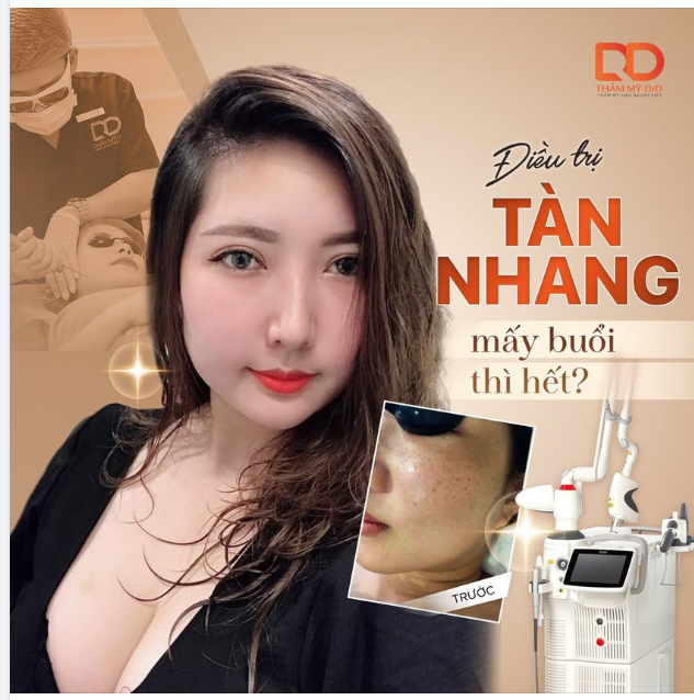 ĐIỀU TRỊ TÀN NHANG MẤY BUỔI THÌ HẾT?
