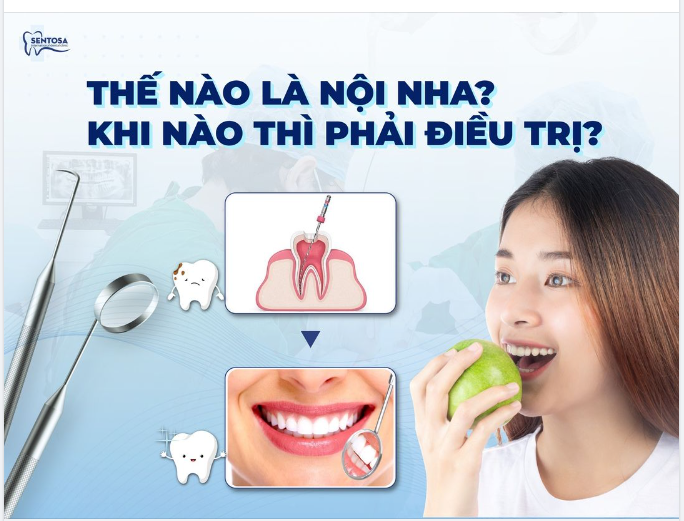 THẾ NÀO LÀ NỘI NHA? KHI NÀO THÌ PHẢI ĐIỀU TRỊ?