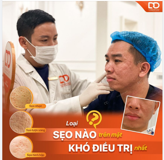 LOẠI SẸO LÕM NÀO TRÊN MẶT KHÓ ĐIỀU TRỊ NHẤT?
