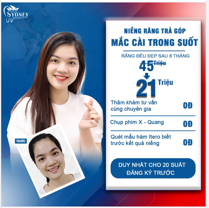 Lợi ích niềng răng trả góp mắc cài trong suốt tại nha khoa Hà nội Sydney