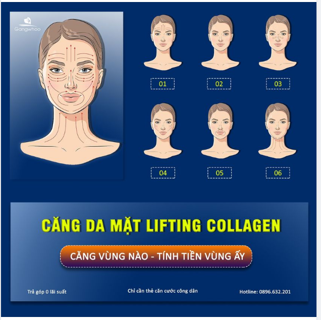 CĂNG DA MẶT LIFTING COLLAGEN - CĂNG VÙNG NÀO, TÍNH TIỀN VÙNG ẤY