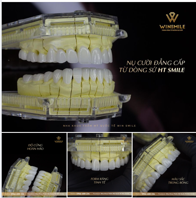 VẺ ĐẸP CHÂN THẬT ĐẾN HOÀN MỸ TỪ DÒNG SỨ HT SMILE