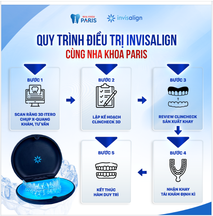 QUY TRÌNH 5 BƯỚC NIỀNG RĂNG INVISALIGN CHUẨN BỆNH VIỆN TẠI NHA KHOA PARIS