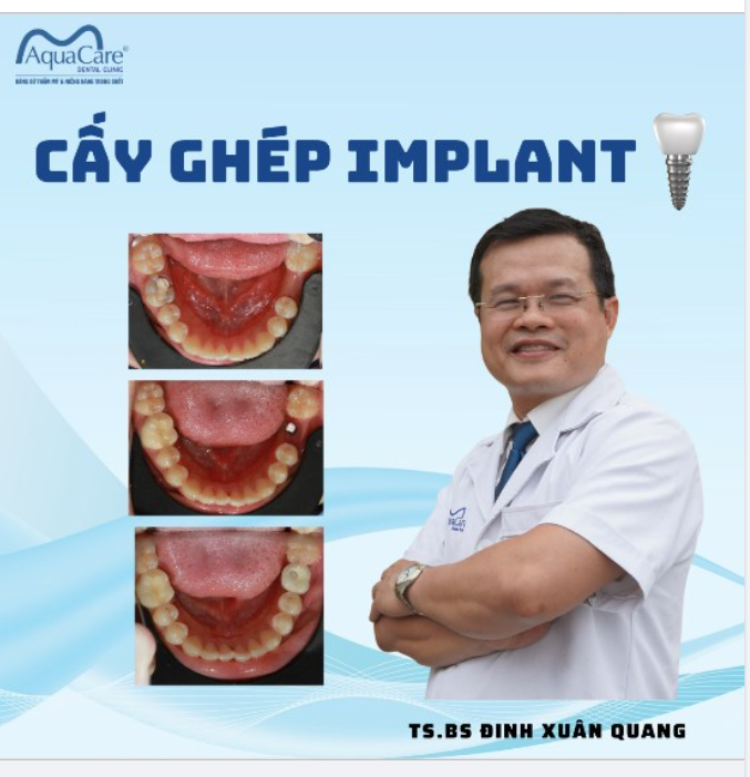 BIẾN CHỨNG NGUY HIỂM KHI MẤT RĂNG