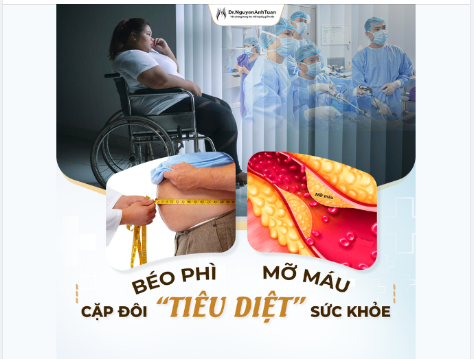 BÉO PHÌ, MỠ MÁU - CẶP ĐÔI "TIÊU DIỆT" SỨC KHỎE