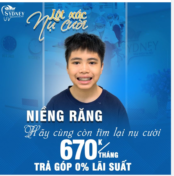 Đâu là độ tuổi "vàng" nên cho trẻ niềng răng?