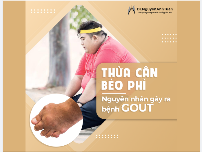 THỪA CÂN - BÉO PHÌ nguyên nhân gây ra bệnh GOUT
