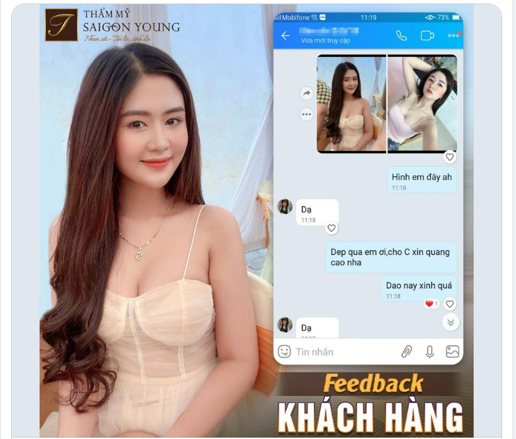 DIỆN MẠO XINH ĐẸP SAU KHI NÂNG NGỰC