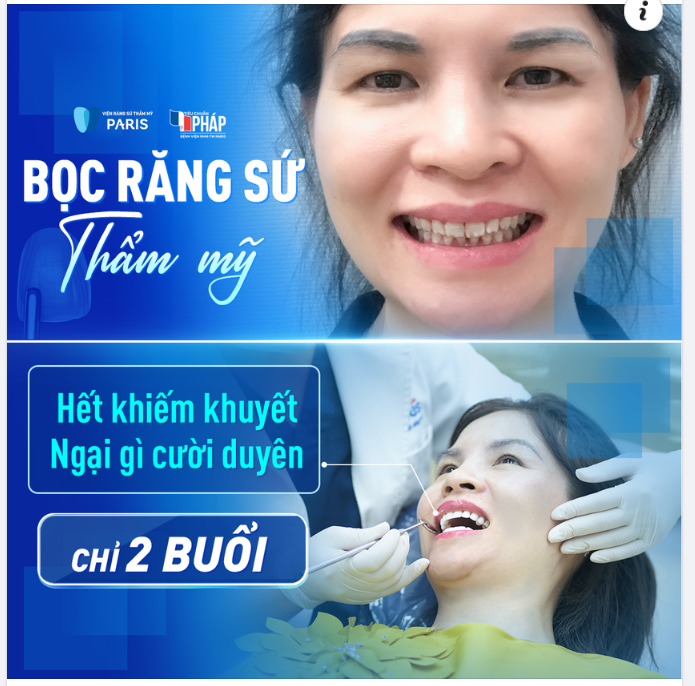 HẾT KHIẾM KHUYẾT - NGẠI GÌ CƯỜI DUYÊN