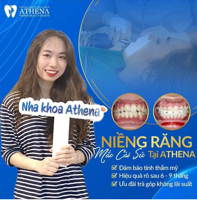 NIỀNG RĂNG MẮC CÀI SỨ - HIỆU QUẢ VÀ THẨM MỸ CAO