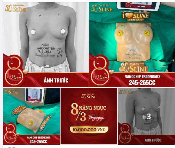 Vậy là 25 tuổi khách hàng của Thẩm Mỹ Viện Sline đã tậu thành công “cặp loa”