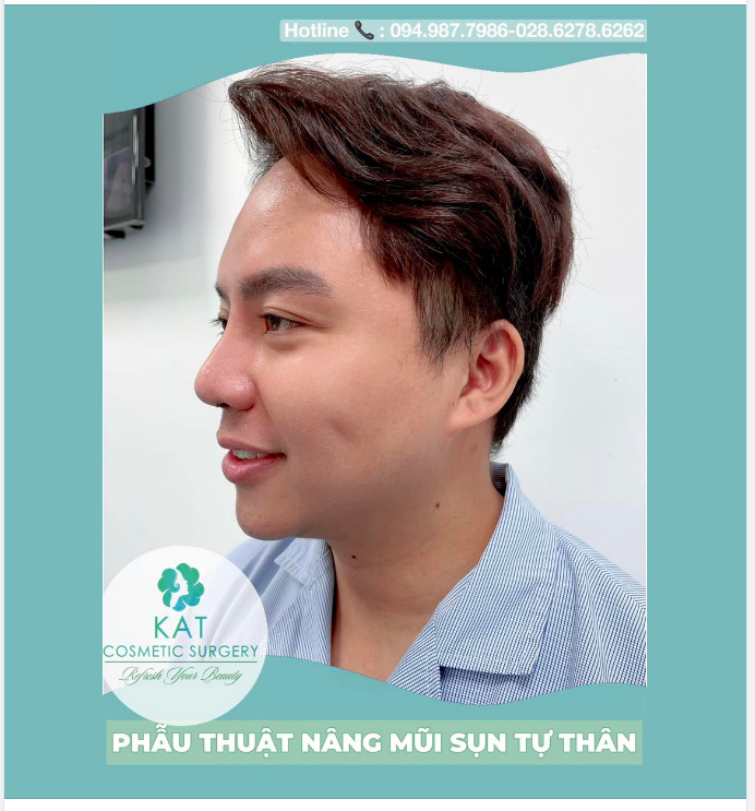 Tuy nhiên tâm lý chung của cánh mày râu khi tân trang nhan sắc vẫn là kín đáo và không muốn người khác phát hiện.