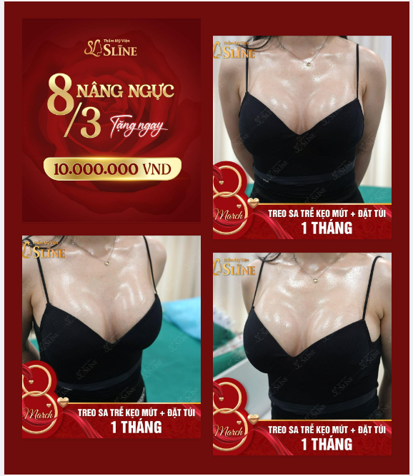 SAU 1 THÁNG NGỰC ĐẸP HÚT MẮT